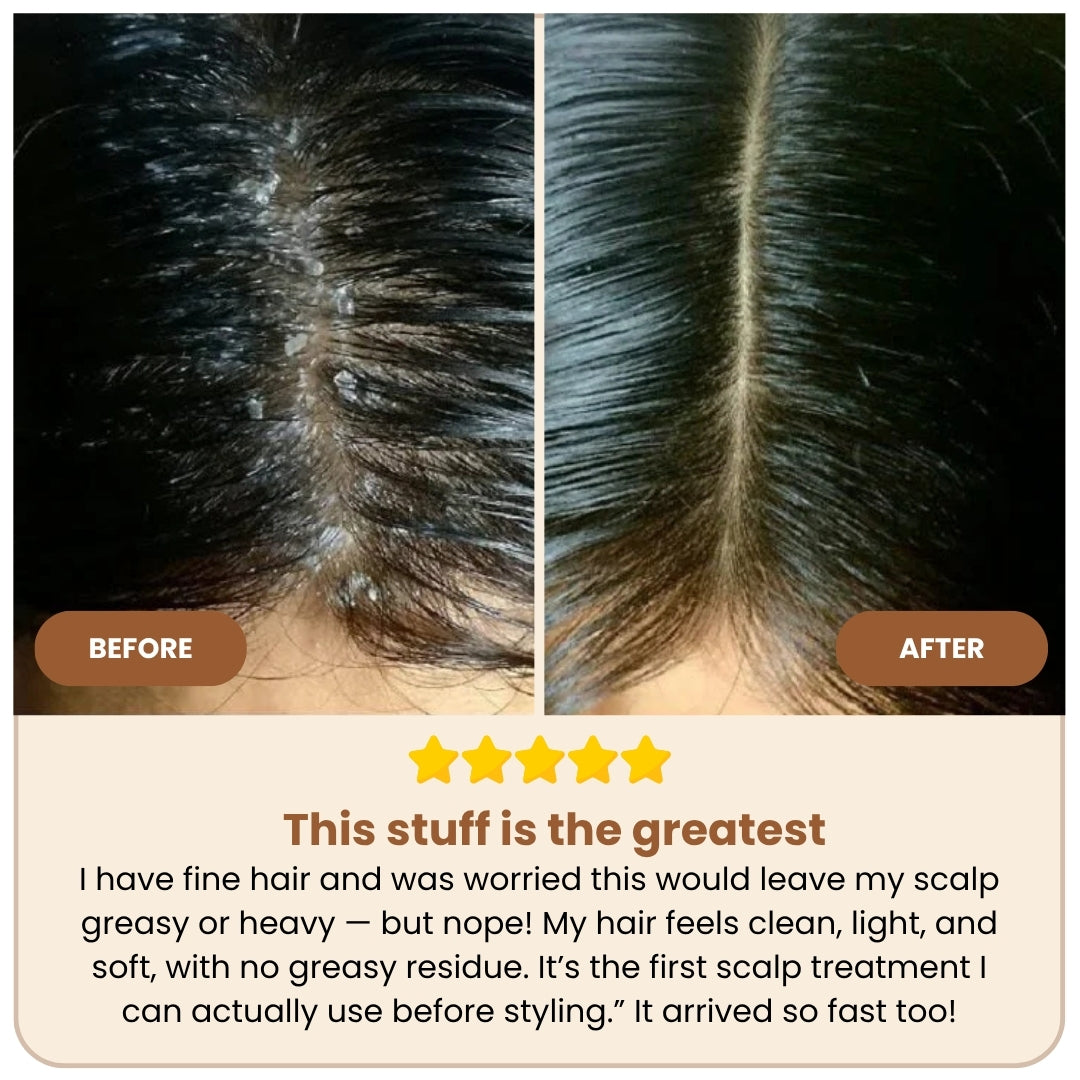 Organic Beef Tallow Shampoo • Scalp Barrier Repair